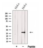 FKBP14 Antibody in Western Blot (WB)