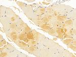 FKTN Antibody in Immunohistochemistry (Paraffin) (IHC (P))