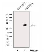 GALNT14 Antibody in Western Blot (WB)