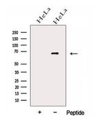 GALNT4 Polyclonal Antibody