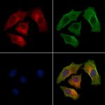 GBF1 Polyclonal Antibody