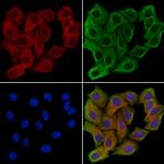 GOLGB1 Polyclonal Antibody