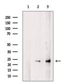 GNPNAT1 Polyclonal Antibody