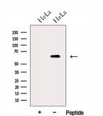 GPR177 Antibody in Western Blot (WB)