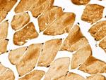GPX8 Antibody in Immunohistochemistry (Paraffin) (IHC (P))