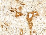 GPX8 Antibody in Immunohistochemistry (Paraffin) (IHC (P))