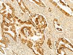 GPX8 Antibody in Immunohistochemistry (Paraffin) (IHC (P))