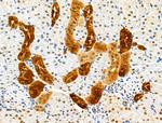 GPX8 Antibody in Immunohistochemistry (Paraffin) (IHC (P))