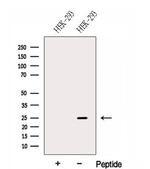 GPX8 Antibody in Western Blot (WB)