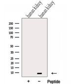 Gtf2h5 Polyclonal Antibody