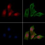 HEATR2 Polyclonal Antibody