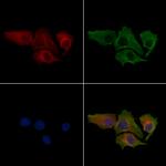 HIBCH Polyclonal Antibody