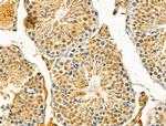 HIBCH Antibody in Immunohistochemistry (Paraffin) (IHC (P))