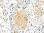 HIBCH Antibody in Immunohistochemistry (Paraffin) (IHC (P))