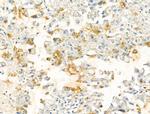 HIBCH Antibody in Immunohistochemistry (Paraffin) (IHC (P))