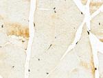 hnRNP H3 Antibody in Immunohistochemistry (Paraffin) (IHC (P))