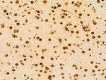 hnRNP H3 Antibody in Immunohistochemistry (Paraffin) (IHC (P))