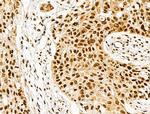 hnRNP H3 Antibody in Immunohistochemistry (Paraffin) (IHC (P))