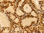 hnRNP H3 Antibody in Immunohistochemistry (Paraffin) (IHC (P))