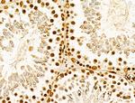hnRNP H3 Antibody in Immunohistochemistry (Paraffin) (IHC (P))