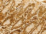 hnRNP H3 Antibody in Immunohistochemistry (Paraffin) (IHC (P))
