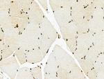 hnRNP H3 Antibody in Immunohistochemistry (Paraffin) (IHC (P))