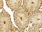 hnRNP H3 Antibody in Immunohistochemistry (Paraffin) (IHC (P))