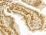 hnRNP H3 Antibody in Immunohistochemistry (Paraffin) (IHC (P))