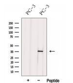 hnRNP H3 Antibody in Western Blot (WB)