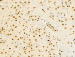 hnRNP R Antibody in Immunohistochemistry (Paraffin) (IHC (P))