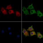 STCH Polyclonal Antibody