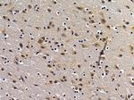 STCH Antibody in Immunohistochemistry (Paraffin) (IHC (P))