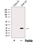 C14orf179 Polyclonal Antibody