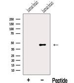 MIIP Antibody in Western Blot (WB)