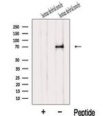 IL1RAPL1 Polyclonal Antibody