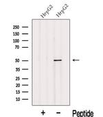 PHF22 Polyclonal Antibody