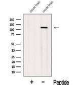 INTS3 Antibody in Western Blot (WB)