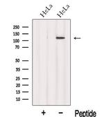 INTS8 Polyclonal Antibody