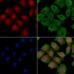 IRF2BP2 Polyclonal Antibody