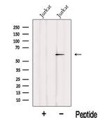 IRF2BP2 Antibody in Western Blot (WB)