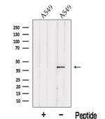 ITM2A Polyclonal Antibody