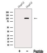 KANK2 Polyclonal Antibody