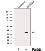 KCNE4 Polyclonal Antibody