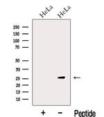 KCTD5 Antibody in Western Blot (WB)