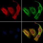 GSE1 Antibody in Immunocytochemistry (ICC/IF)