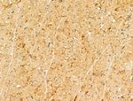 GSE1 Antibody in Immunohistochemistry (Paraffin) (IHC (P))
