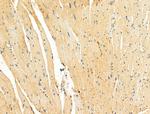 GSE1 Antibody in Immunohistochemistry (Paraffin) (IHC (P))
