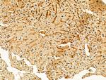 GSE1 Antibody in Immunohistochemistry (Paraffin) (IHC (P))