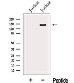 GSE1 Antibody in Western Blot (WB)