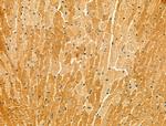 KIAA1033 Polyclonal Antibody